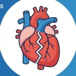 Know Heart Failure Symptoms and Causes
