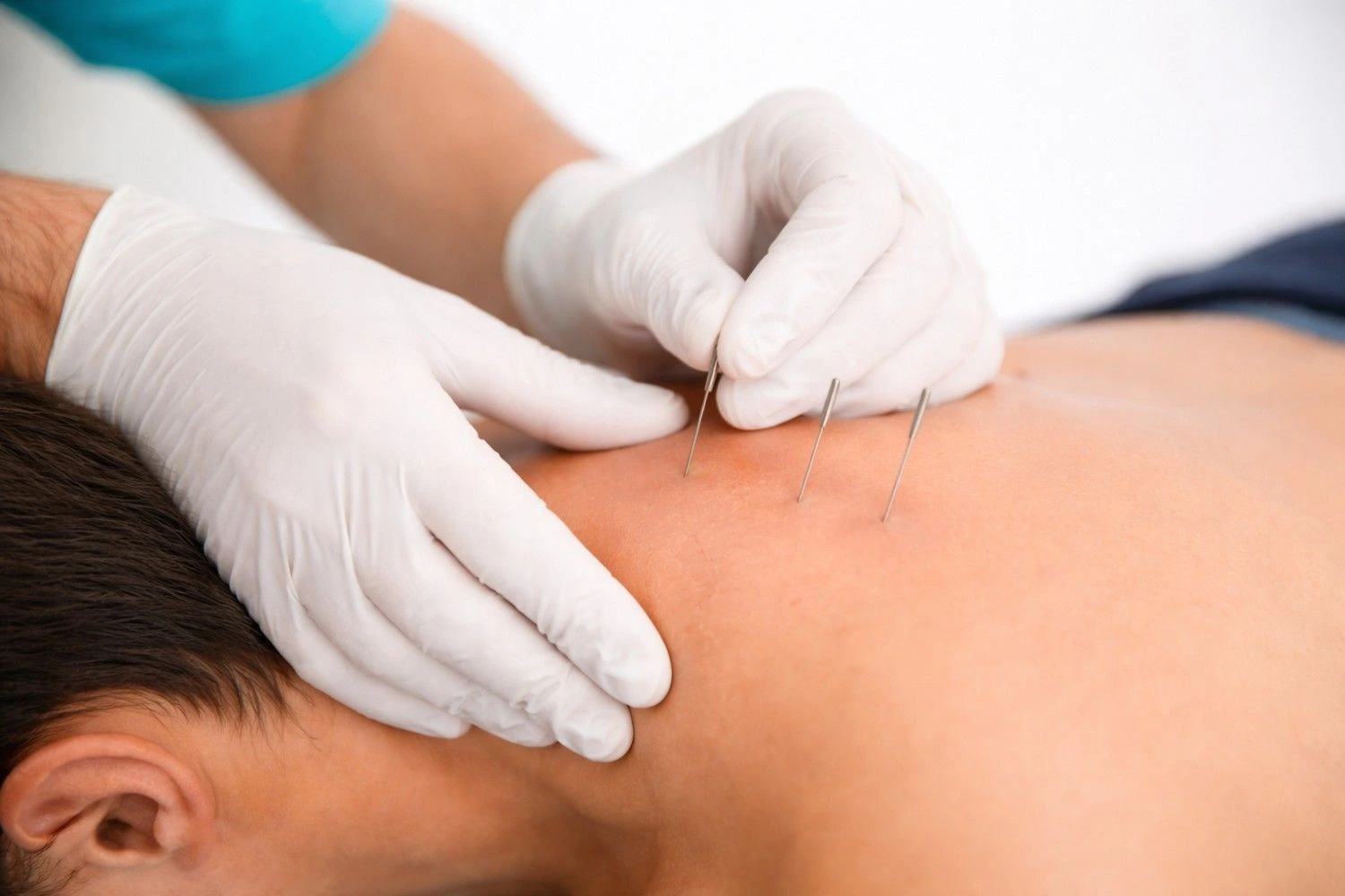 Physiotherapy Hospital in Boduppal