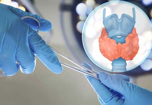Thyroid Surgery Boduppal