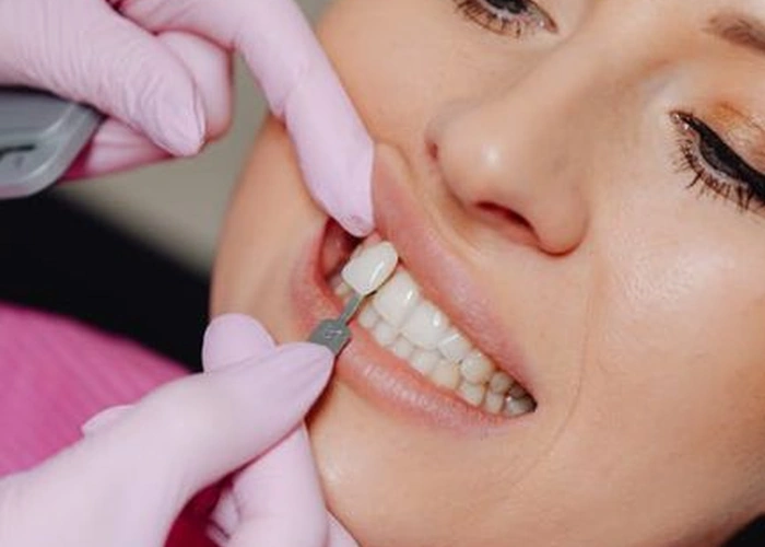Dental Implants