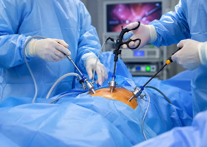 Laparoscopic Gynaecology