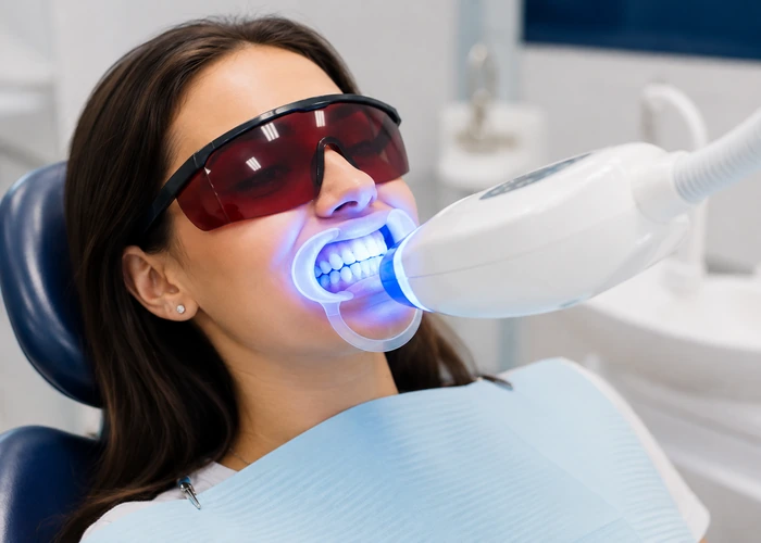 Teeth Whitening
