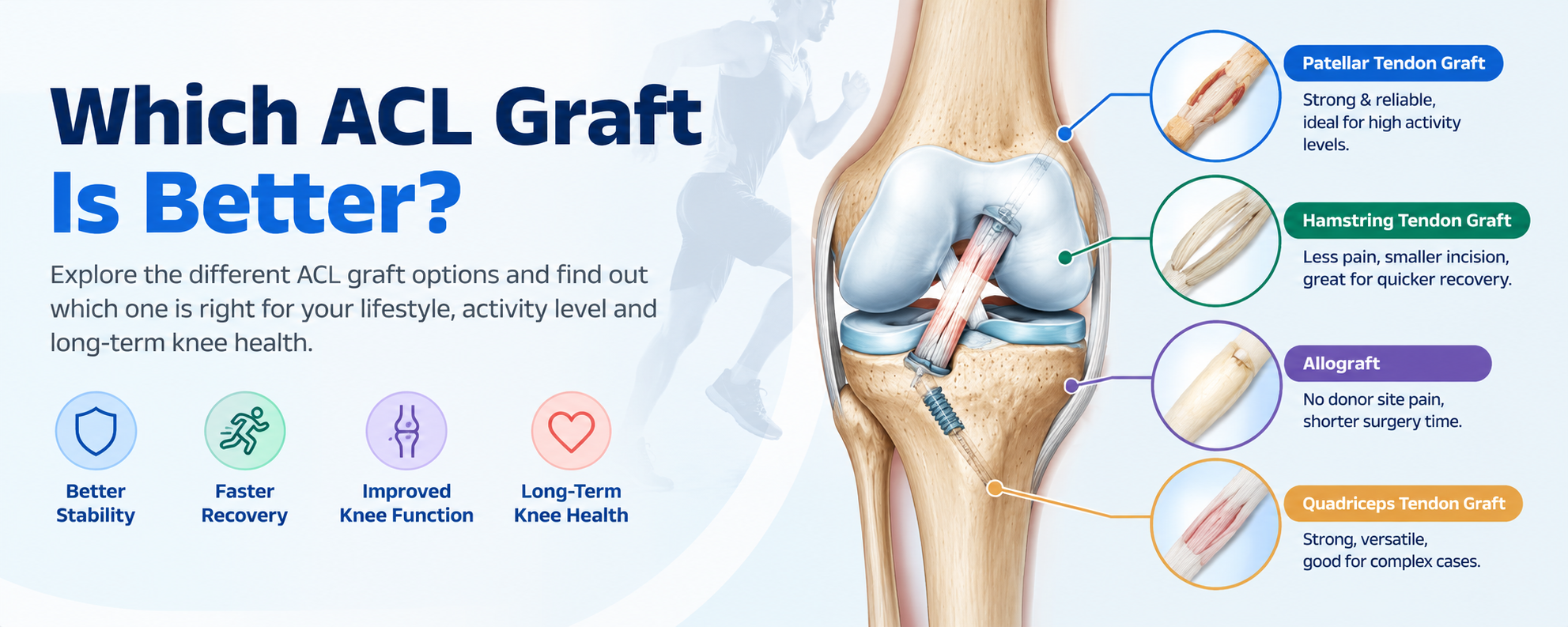 Which ACL Graft Is Better